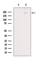 PTPRB Antibody in Western Blot (WB)