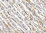 PTPRK Polyclonal Antibody