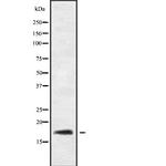 RGS21 Antibody in Western Blot (WB)