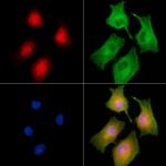 RGS22 Polyclonal Antibody