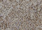 RGS22 Antibody in Immunohistochemistry (Paraffin) (IHC (P))