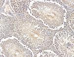 RGS22 Antibody in Immunohistochemistry (Paraffin) (IHC (P))