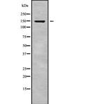 RGS22 Antibody in Western Blot (WB)