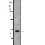 RGS4 Polyclonal Antibody