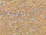 RFPL4B Antibody in Immunohistochemistry (Paraffin) (IHC (P))