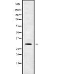 RFPL4B Antibody in Western Blot (WB)