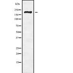 RBBP6 Antibody in Western Blot (WB)