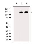 ARHGAP12 Polyclonal Antibody