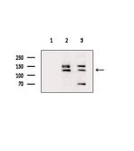 ARHGAP20 Antibody in Western Blot (WB)