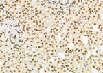 ARHGAP23 Antibody in Immunohistochemistry (Paraffin) (IHC (P))