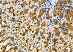 ARHGAP24 Polyclonal Antibody
