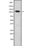ARHGAP30 Antibody in Western Blot (WB)