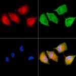 ARHGAP6 Polyclonal Antibody