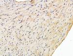 ARHGAP6 Antibody in Immunohistochemistry (Paraffin) (IHC (P))