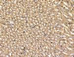 ARHGAP6 Antibody in Immunohistochemistry (Paraffin) (IHC (P))