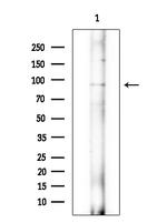 ARHGAP6 Antibody in Western Blot (WB)