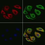 ARHGEF6 Polyclonal Antibody