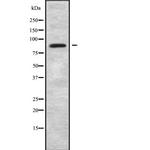 ARHGEF6 Antibody in Western Blot (WB)