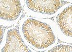 RND2 Antibody in Immunohistochemistry (Paraffin) (IHC (P))