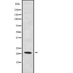 RHOXF1 Antibody in Western Blot (WB)
