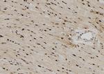RPS6KL1 Antibody in Immunohistochemistry (Paraffin) (IHC (P))