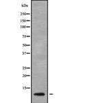 SERP1 Antibody in Western Blot (WB)
