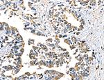 RPAP3 Antibody in Immunohistochemistry (Paraffin) (IHC (P))