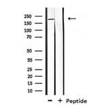 CROCC Polyclonal Antibody