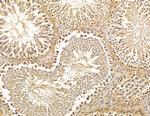 SCARA3 Antibody in Immunohistochemistry (Paraffin) (IHC (P))