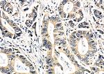 SEPT11 Polyclonal Antibody