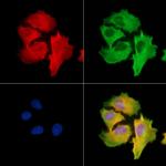 STK31 Polyclonal Antibody