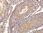 STK31 Antibody in Immunohistochemistry (Paraffin) (IHC (P))