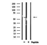 STK38L Antibody in Western Blot (WB)