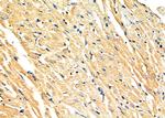 NEK4 Polyclonal Antibody