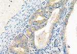 PIM2 Antibody in Immunohistochemistry (Paraffin) (IHC (P))
