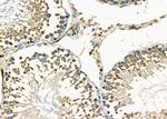 PIM2 Antibody in Immunohistochemistry (Paraffin) (IHC (P))