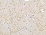 SRPK2 Polyclonal Antibody