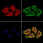 ULK4 Polyclonal Antibody