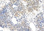PPP4R1 Polyclonal Antibody
