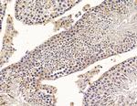 SCML2 Polyclonal Antibody
