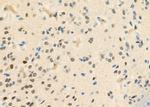 STAC3 Polyclonal Antibody