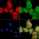 SH3PXD2A Polyclonal Antibody