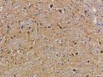 SH3TC2 Polyclonal Antibody