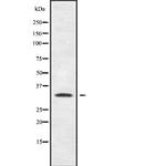 SHOX Polyclonal Antibody