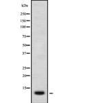 CXCL11 Polyclonal Antibody