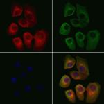 SLC6A11 Polyclonal Antibody