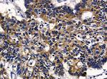 SLC6A14 Antibody in Immunohistochemistry (Paraffin) (IHC (P))