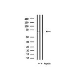 SLC6A20 Polyclonal Antibody