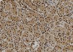 SCNM1 Polyclonal Antibody