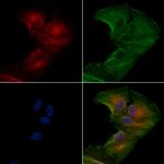 SCN11A Polyclonal Antibody